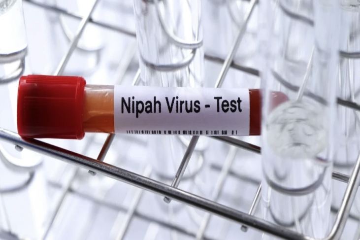 ÜST: Hindistanda Nipah virusunun yayılma riski azdır 