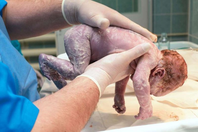 Ölü doğulan uşağın zirzəmiyə atılması iddiası ilə bağlı klinikadan açıqlama 
